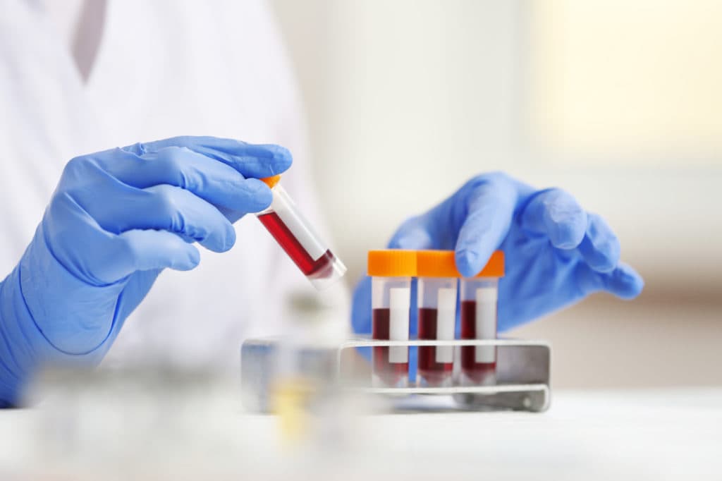 Badania laboratoryjne - pobieranie krwi